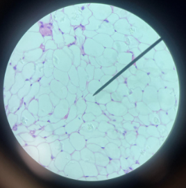 <p>Location: Found all through the body</p><p>Function: Fat, Cushion and Protection</p><p>Connective Tissue</p>