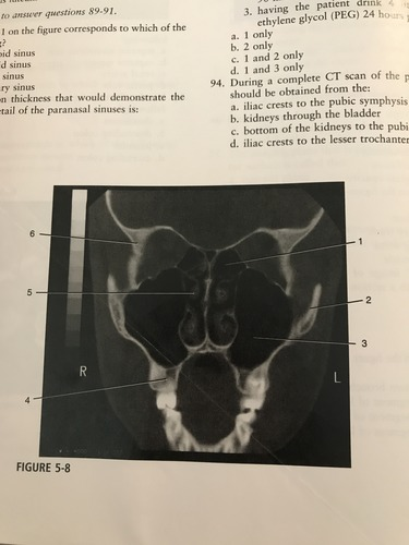 <p>Number 1 on the figure corresponds to which of the following?</p><p>A) sphenoid sinus</p><p>B) ethmoid sinus</p><p>C) frontal sinus'</p><p>D) maxillary sinus</p>