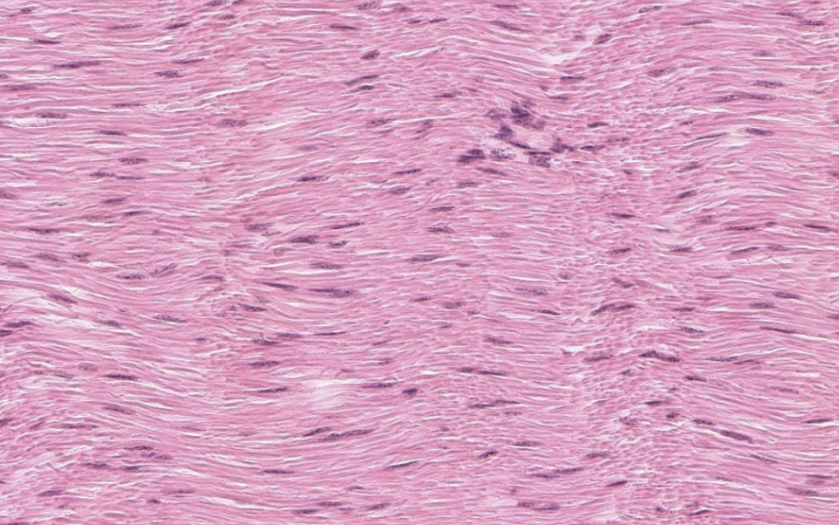 <p>are elastic ligaments categorised as dense regular or dense irregular CT?</p>
