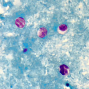 <p>Modified Acid Fast Stain</p>