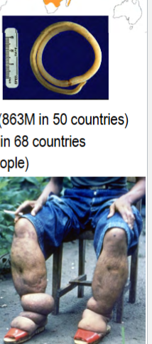 <p>endoparasites in phylum Nematoda</p><p>cause elephantiasis (lymphatic filariasis)</p><p>spread mainly by biting insects (e.g. mosquitos and blk flies); infection requires repeated bites over months to years</p><p>live in human lymph system usually undetected</p><p>some have swelling due to blocked lymph nodes</p>