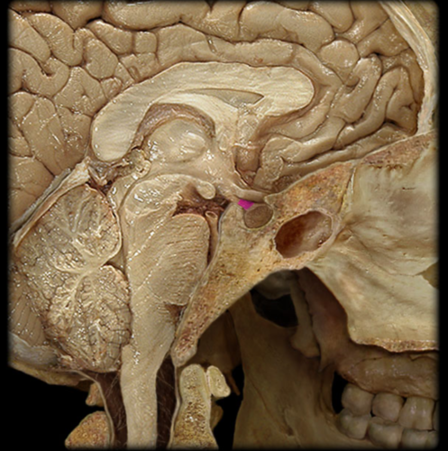 <p>Infundibulum of Pituitary Gland</p>
