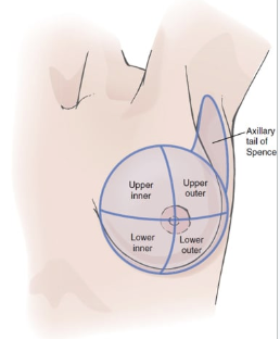 <p>The Axillary Tail of Spence because most breast cancers develop there. This region has the highest volume of glandular and ductal tissue</p>