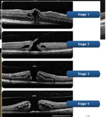 <p>Name the condition</p>