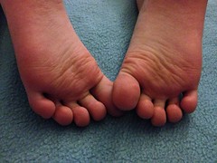 <p>sole of the foot (inferior body surface)</p>