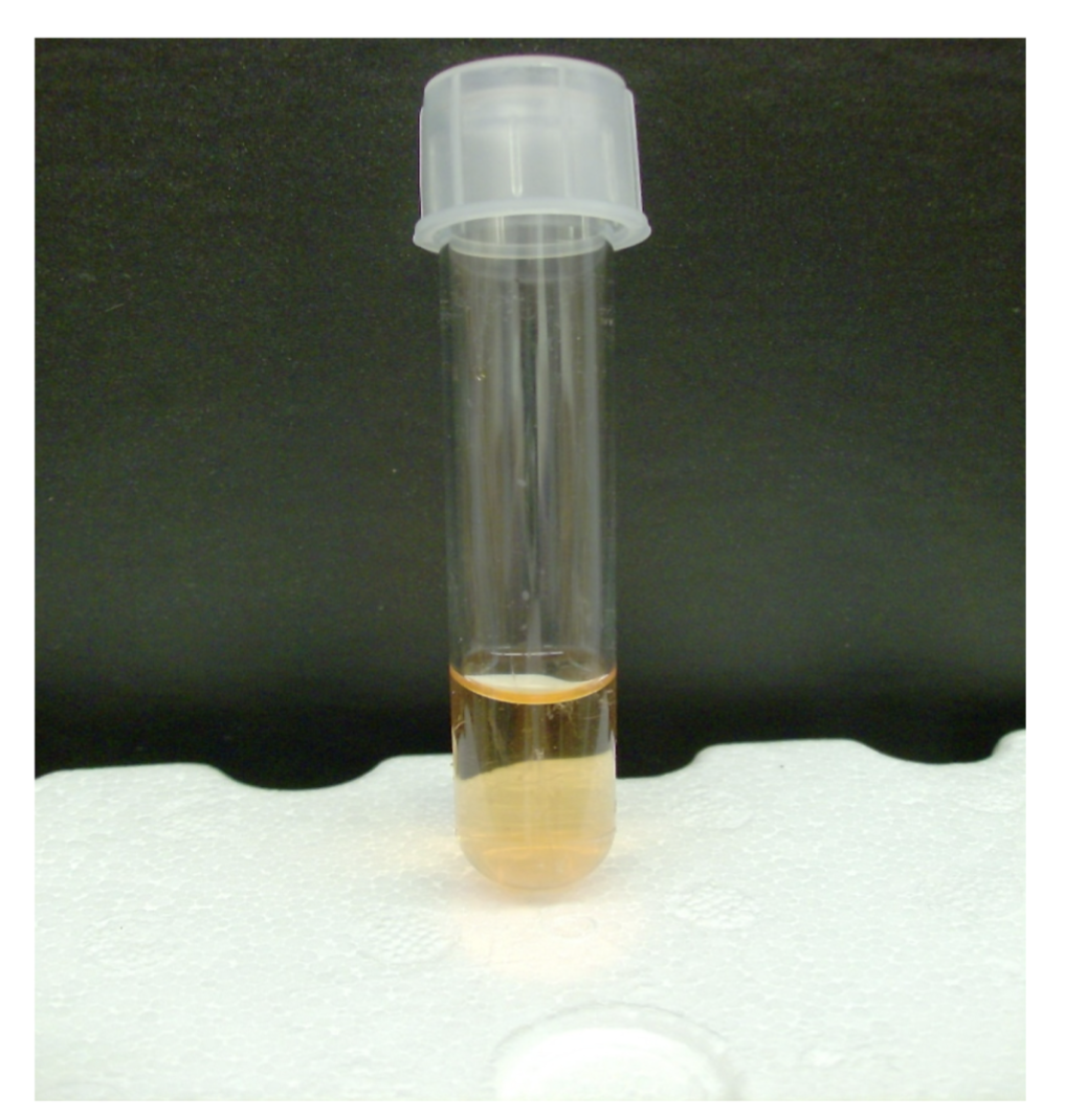 <p>what is the test and result?</p>