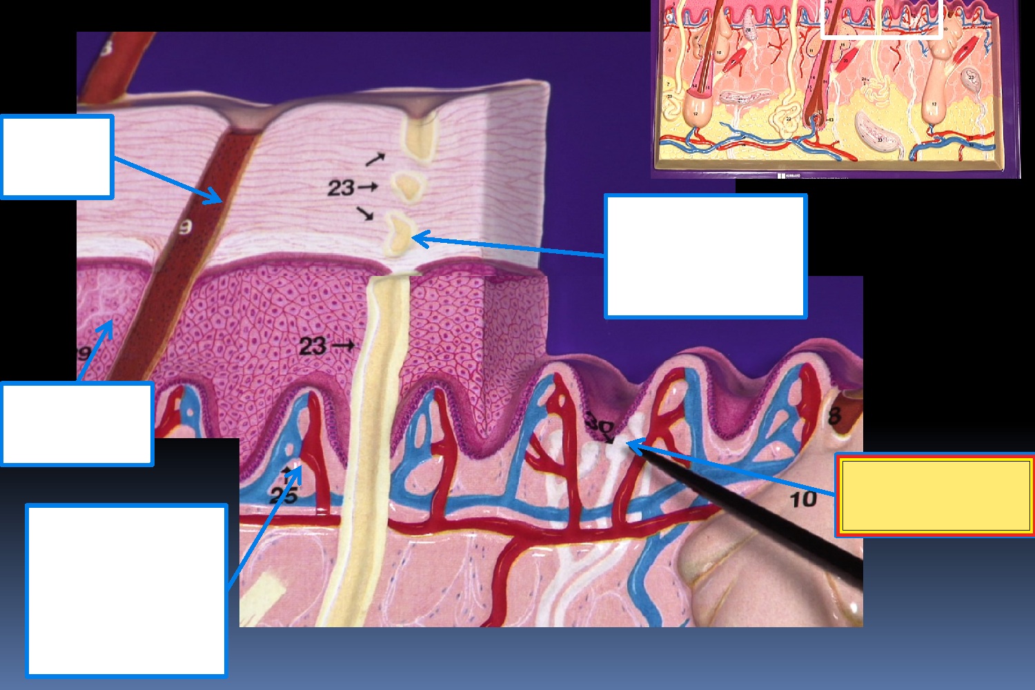 <p>Identify the highlighted structure</p>