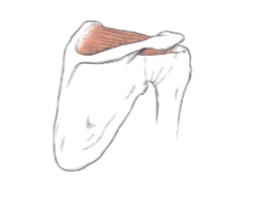 <p>What muscle is this?</p>