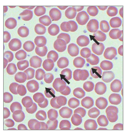 <p>What are the 4 functions of platelets?<br></p>