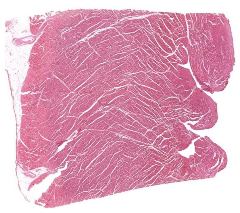 <p>Which ventricle is this? </p>