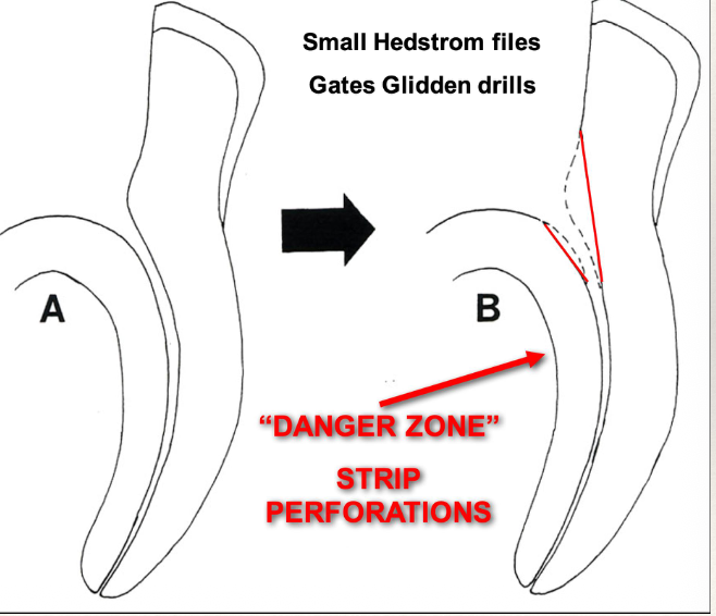 <p>What is the “danger zone”?</p>
