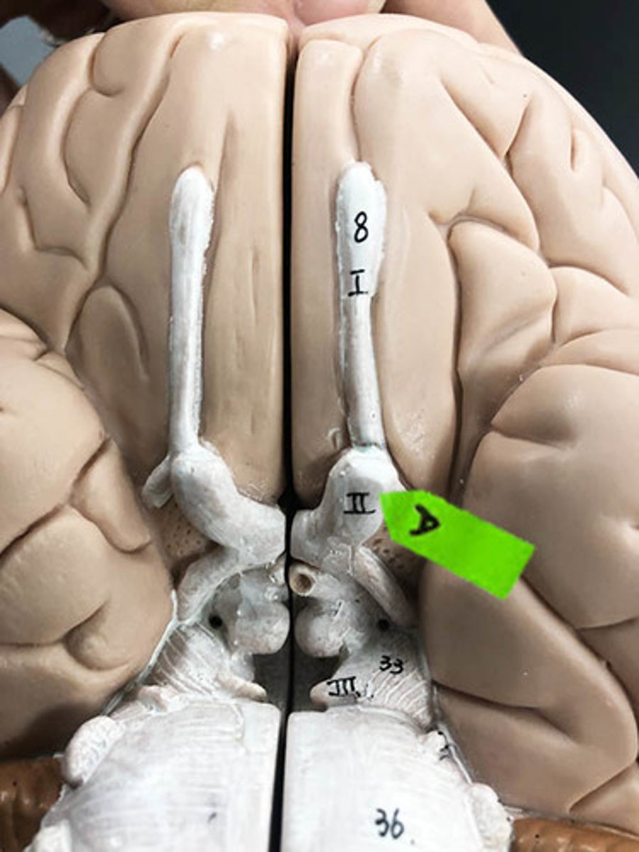 <p>Identify the name and number of this cranial nerve.</p>