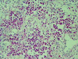 <p>methyl green pyronin y reagents:</p><p>pH:</p><p>nucleic acid stain:</p><p>methyl green purifier:</p>