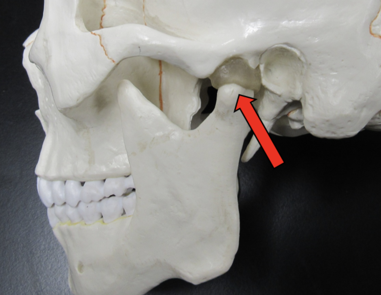 <p><span><strong>Identify the bone marking indicated by the pointer.</strong></span></p>