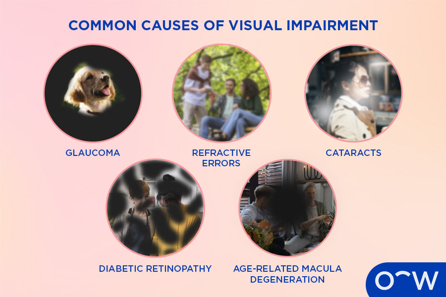 <p>progressive vision loss of central vision </p>