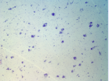 <p>What were these cells stained with? magnification? type of microscopy? </p>