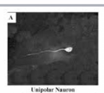 <p>Unipolar Neuron : Function : Carries sensory impulses from receptors to the central nervous system.</p>