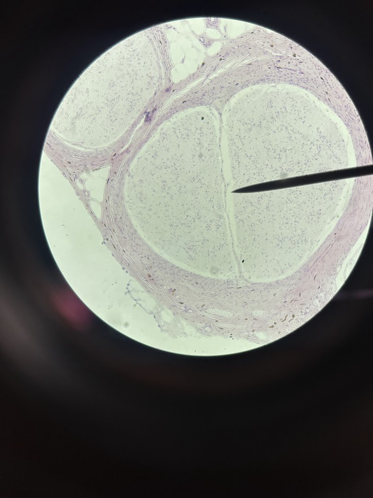 <p>tissue type + darker layer surrounding the lighter structure</p>