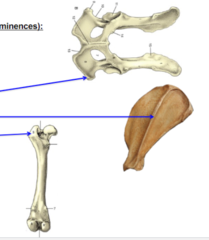 <p>Bone elevations</p><p>What is the 1st (top) blue arrow pointing to?</p>