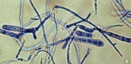 <p>“beaver-tail” shaped macroconidia</p>