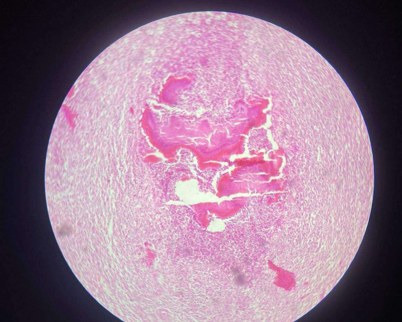 term image