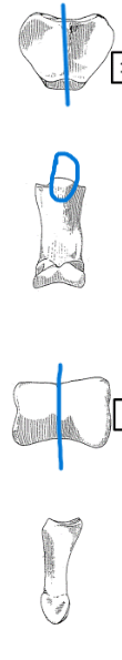 <ul><li><p>symmetrical articulations </p></li><li><p>ridge </p></li></ul><p></p><p>dog intermediate phalanx </p><p></p>