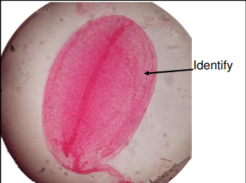 <p>A sensory receptor structure identified on slide pages 1 and 2.</p>