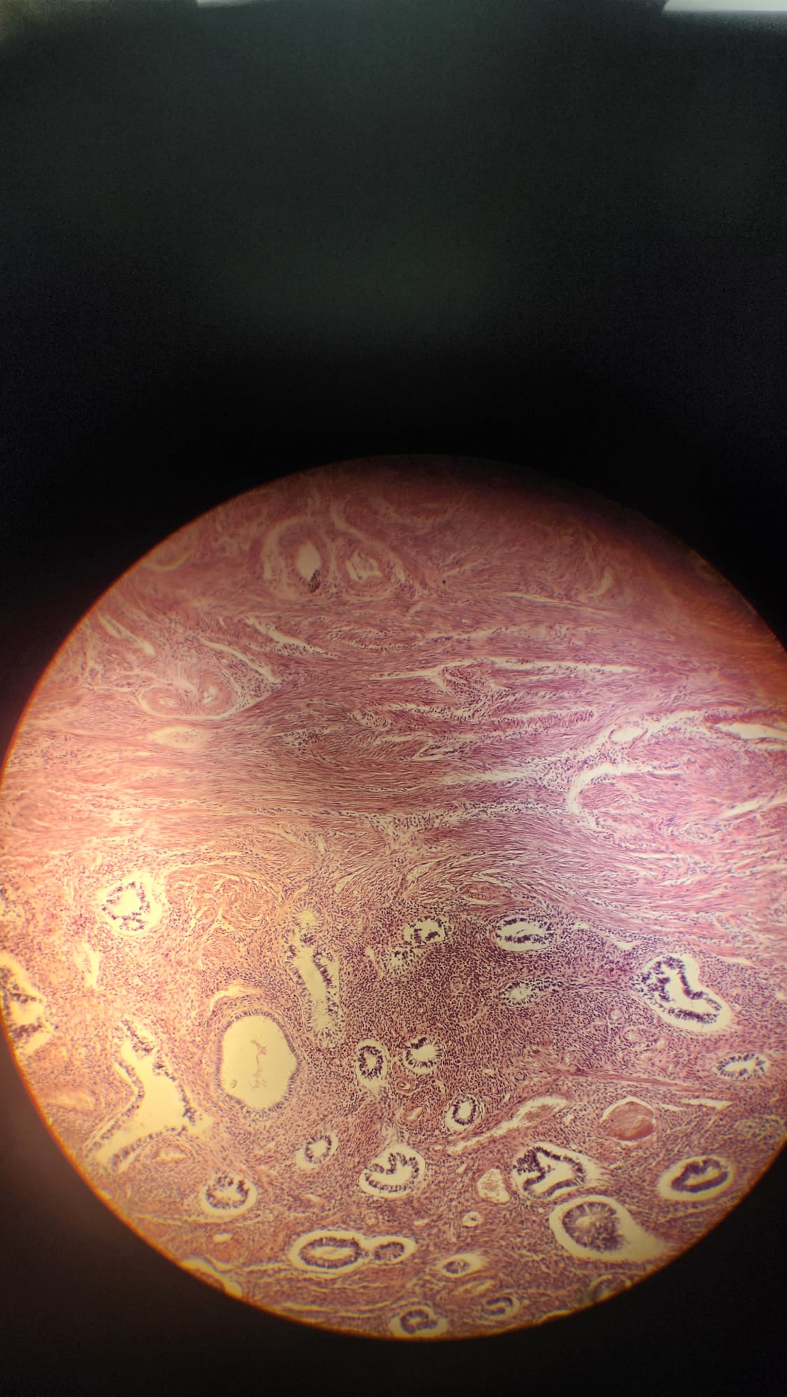 <p>Which organ is this? Name the layers?</p>