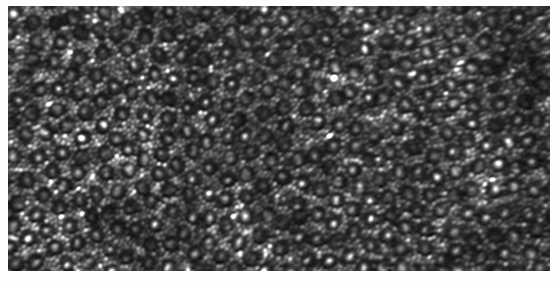 <p>Further out there are rods - smaller cells in between cones</p>