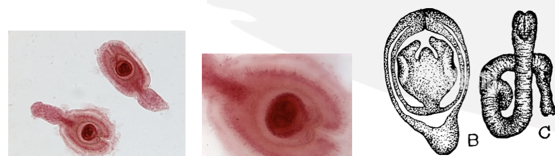 <p>What type of metacestode stage is this?</p>