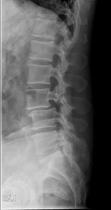 <p>What is the Dx?</p>