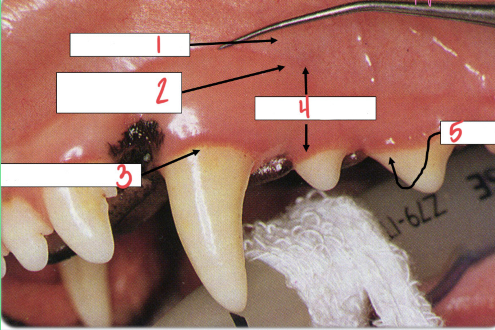 <p>What is 5?</p>