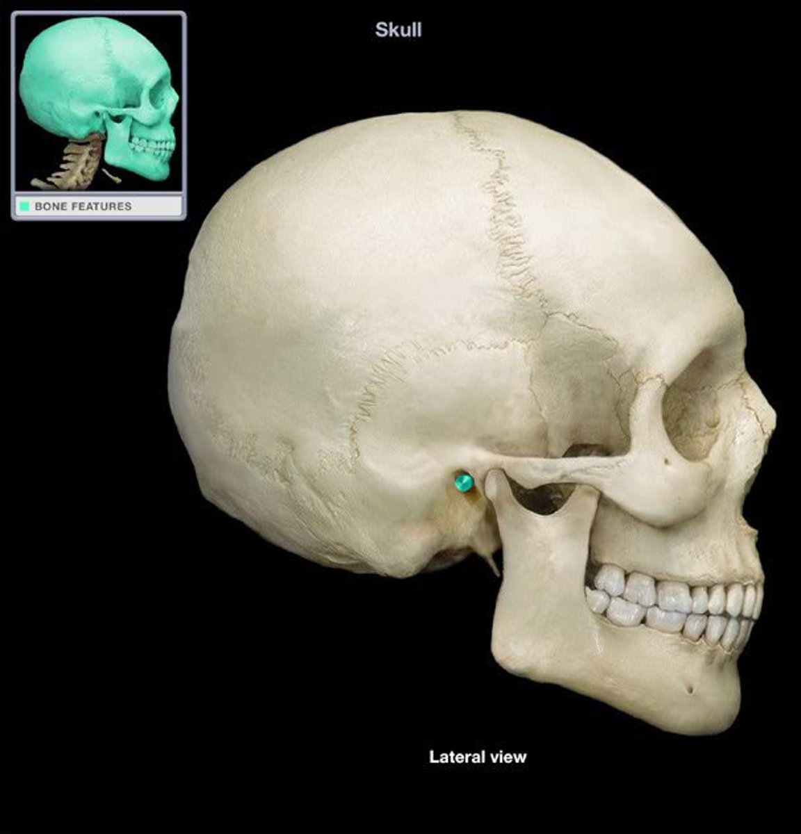 <p>What boney feature is this?</p>