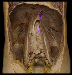 <p>identify the structure</p>