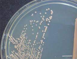 <ul><li><p><span><strong>Colony Appearance:</strong> On initial isolation (e.g., on nutrient agar or blood agar), colonies are typically small (\(2 \text{ to } 3\ mm\)), whitish, round, convex, and raised.</span> [1, 2]</p></li><li><p><span><strong>Pigmentation:</strong> Upon prolonged incubation or under strict aerobic conditions, colonies may develop a dull, creamy appearance with a non-diffusible yellow tinge or yellowish pigmentation.</span> [1, 2]</p></li></ul><p></p>