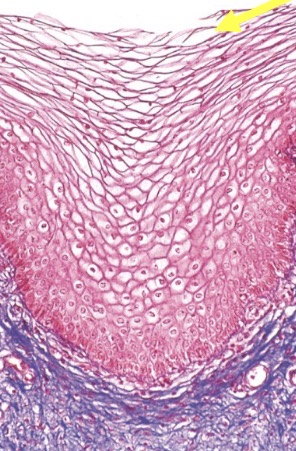 <p>What is the type tissue in this image?</p>