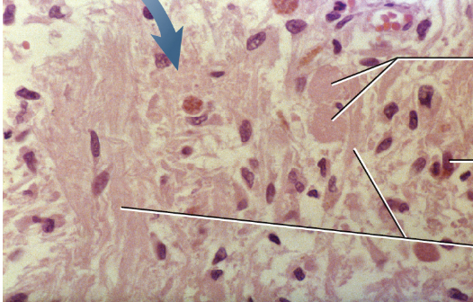 <p>what gland is this</p>