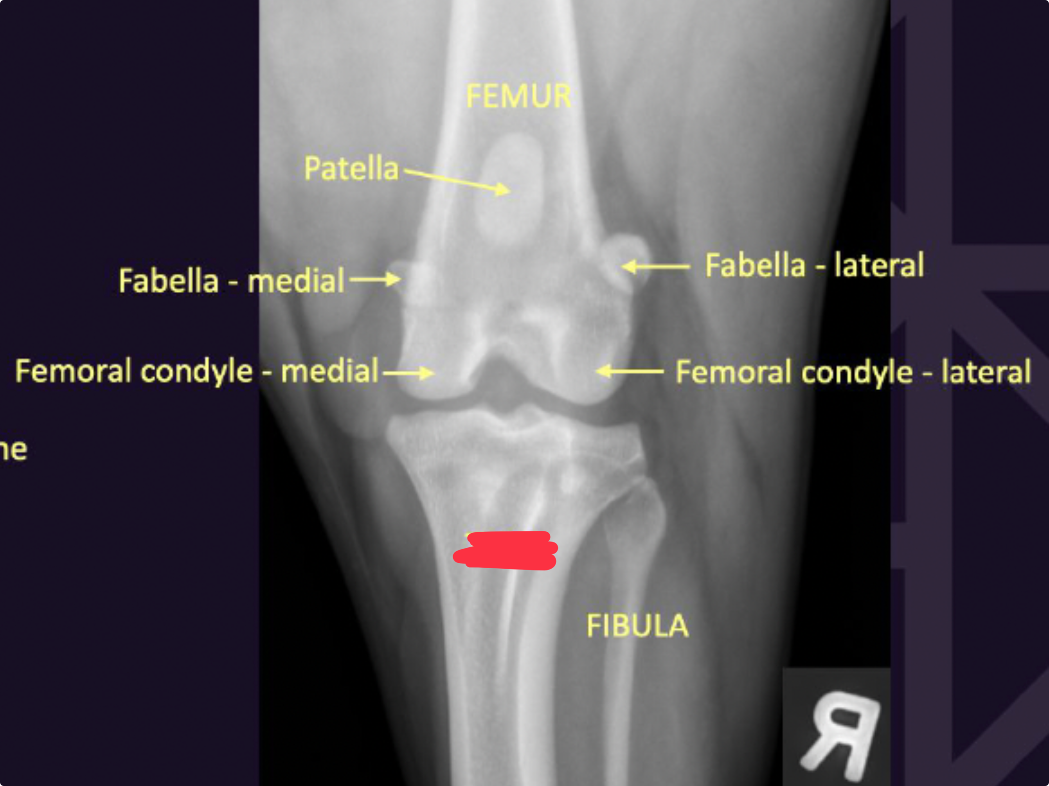 term image