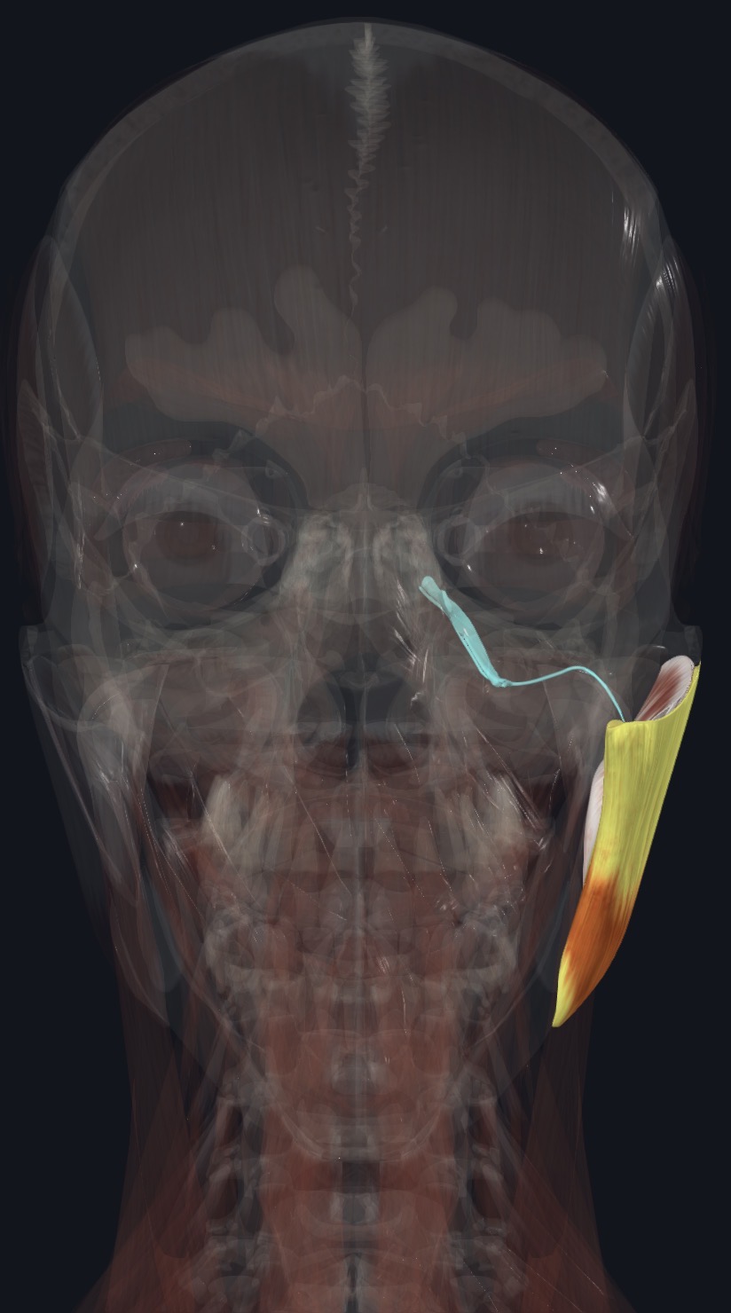 <p>Ant. Trunk of mandibular N (CN V3) Via masseteric nerve</p>