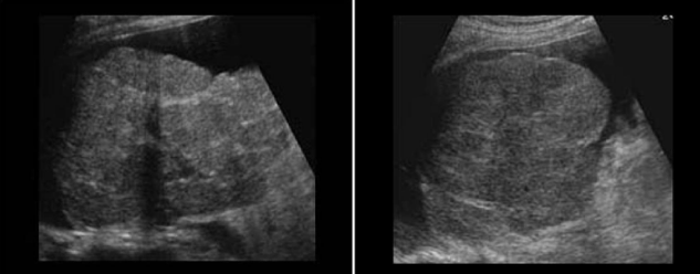 <p>Identify this image. </p>