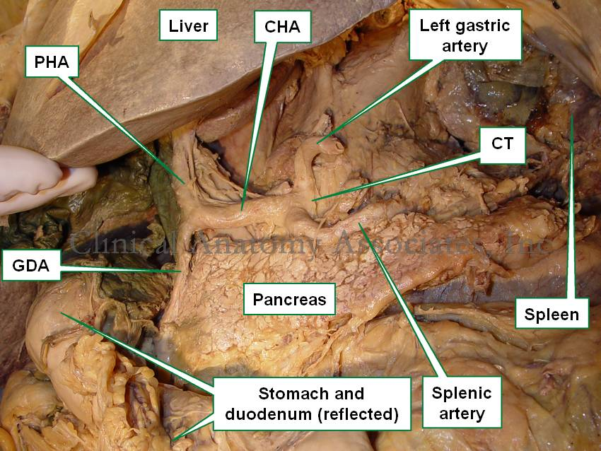 <p>branch (inferior) of the hepatic artery that goes to the right</p><ul><li><p>structure</p></li></ul><p></p>