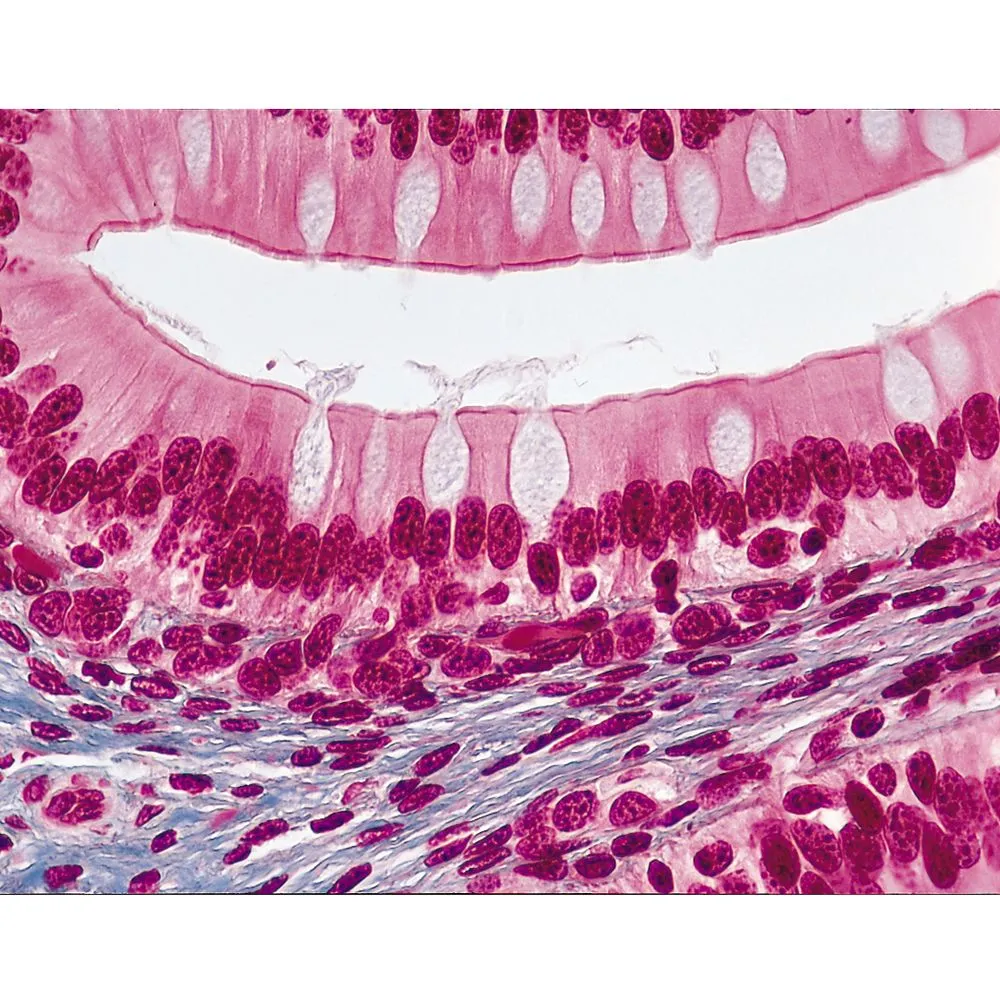 <p>Tall and thin but round nucleus, can be near goblet cells; found in digestive tract, airways, and other tubes (uterine tubes, epididymis, ductus deferens)</p>