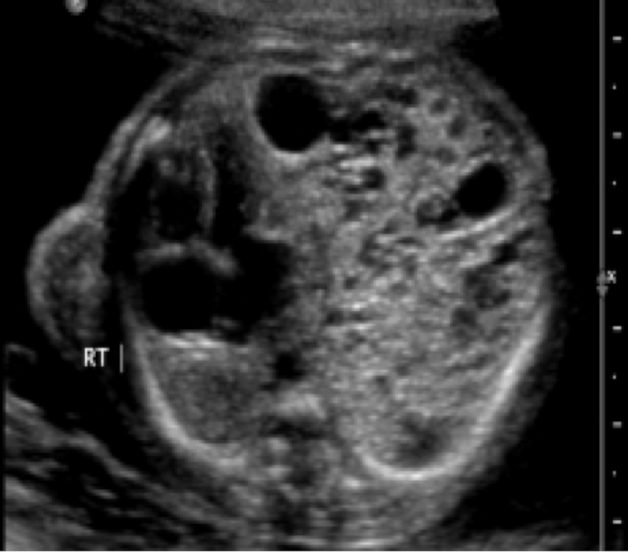 <p>normal or abnormal</p>