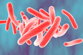 <p>does not gram stain well (stains fuchsia with acid fast stain)</p>