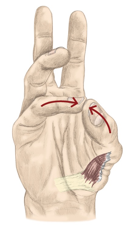 <p><span>opponens pollicis</span></p><p style="text-align: left;"><span>flexor pollicis brevis</span></p><p style="text-align: left;"><span>abductor pollicis brevis&nbsp;</span></p>