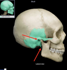 <p>What is the structure that the arrow on the bottom is pointing to?</p>