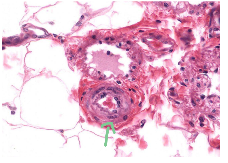 <p>Identify the vessel indicated by the arrow</p>