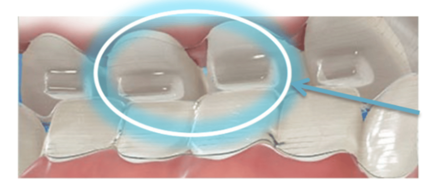 <p>ID feature of aligner:</p>