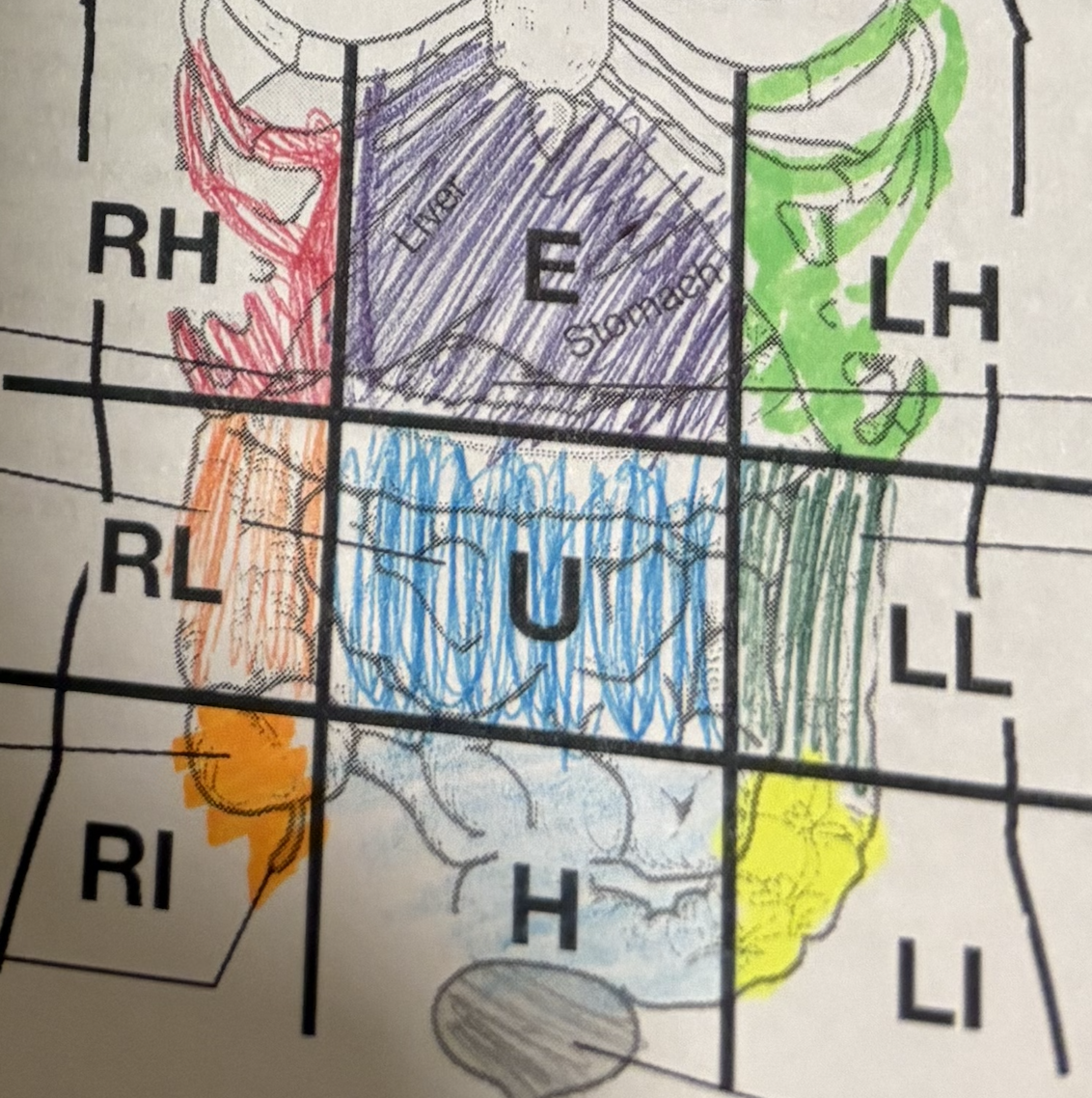 <p>Middle-left abdominopelvic region. </p>