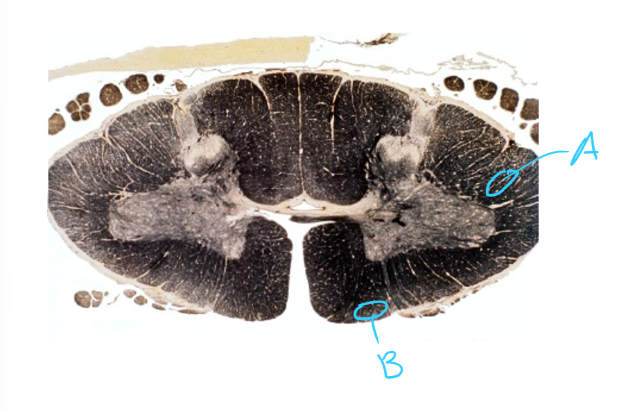 <p>Consider A and B. Describe the path of the neurons and the functions. </p>